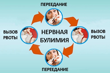 Лечение булимии в Канаше